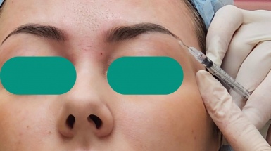Коррекция мимики с помощью уколов
