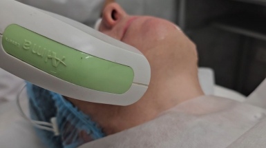 Фотоомоложение IPL Glow Flow