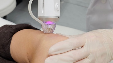 Устранение дряблости кожи