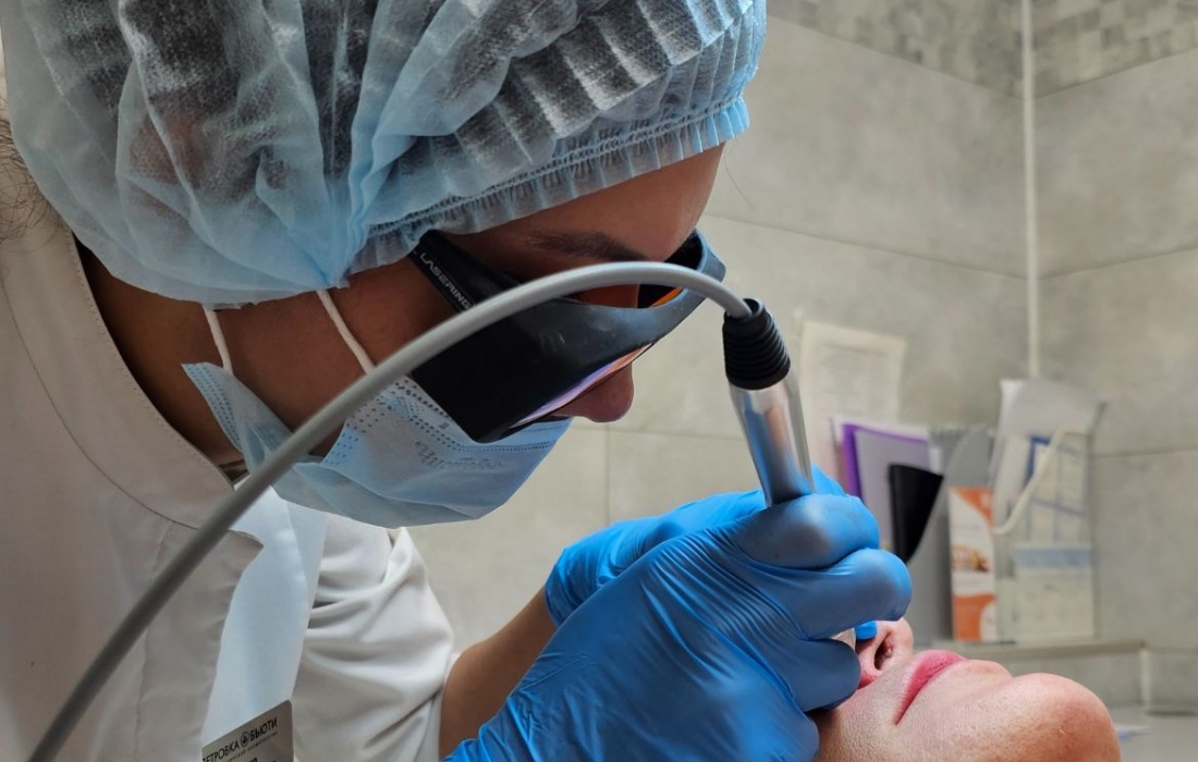 Лазерное удаление родинок в Москве