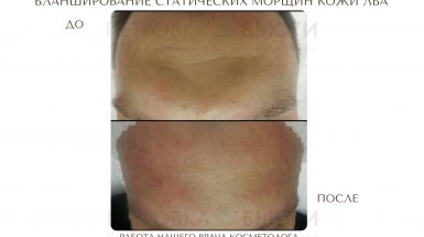 Бланширование статики