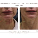 Техника Full Face Всё лицо с косметологом Мартиросян Стеллой