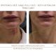 Техника Full Face Всё лицо с косметологом Мартиросян Стеллой